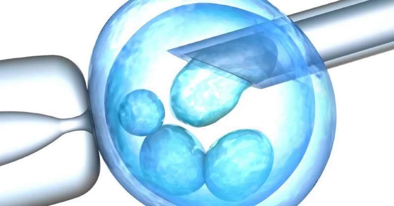 Eξωσωματική  γονιμοποίηση – IVF