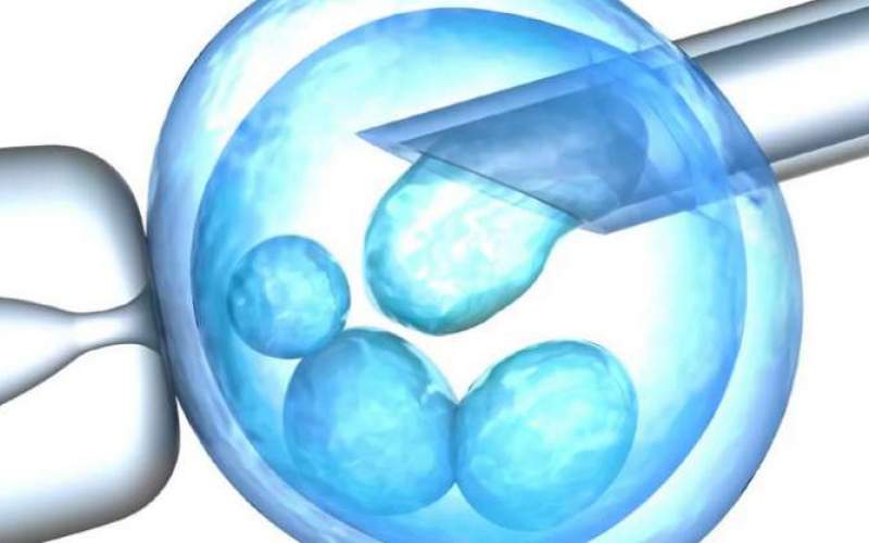 Eξωσωματική  γονιμοποίηση – IVF