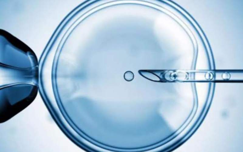 Εικόνα που δείχνεί τρόπο εξωσωματικής  γονιμοποίησης – IVF
